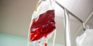 Worek dożylnej kroplówki podłączony do linii infuzyjnej w szpitalu